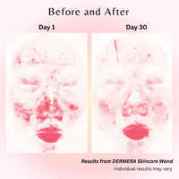 Dermara™ Glow Wand 4-in-1 Red Light Therapy for Radiant Skin