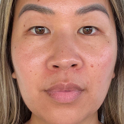 After - Smoother Skin