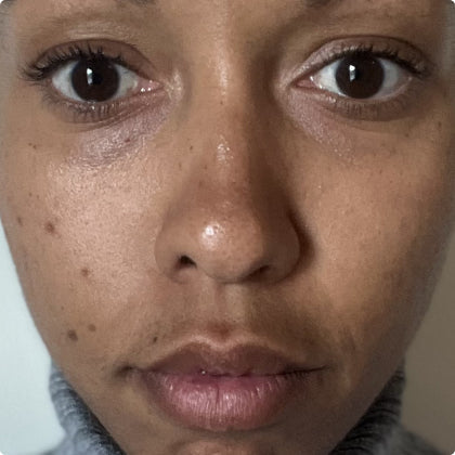 After - Youthful Glow