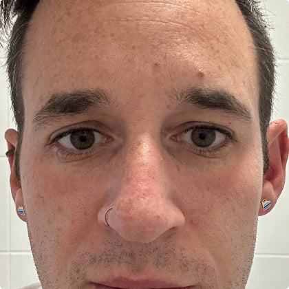 After - Lifted & Firm