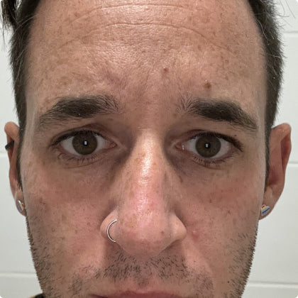 Before - Lifted & Firm